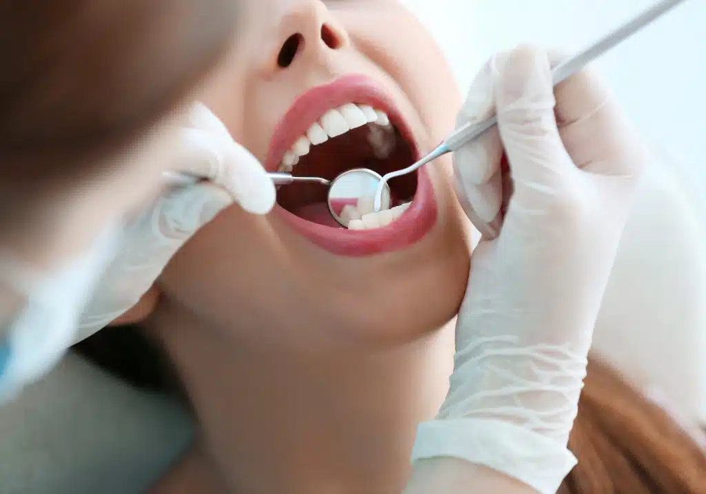 Dental Care While Visiting Bali When You Need A Dentist Dental Care